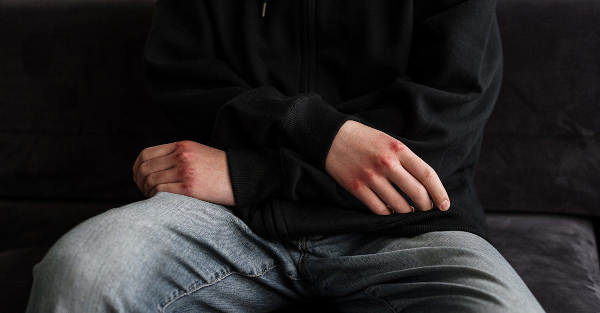 محاولة إشعال حريق وإلقاء مقذوفات